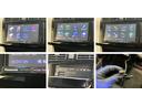 追突被害軽減ブレーキ　スマアシ１　ＬＥＤ　スマートキー　オートエアコン　フルセグナビ　ＤＶＤ　Ｂｌｕｅｔｏｏｔｈ　ＵＳＢ　バックカメラ（滋賀県）の中古車